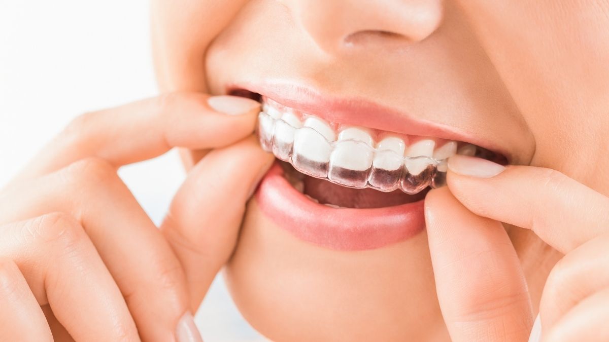 Where to get braces in Seoul Shin Medical